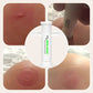 🔥2025 Hot Sale🔥Insect Bug Bee Sting Extractor Suction Tool